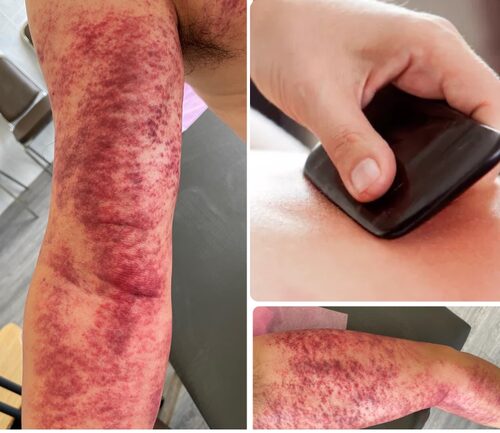 聖儀堂傳統整復推拿  產品圖片 #8